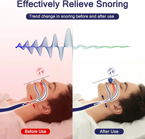 Micro CPAP Sleep Apnea Machine for Travel & Anti-Snoring